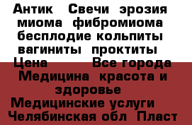 Антик.  Свечи (эрозия, миома, фибромиома, бесплодие,кольпиты, вагиниты, проктиты › Цена ­ 550 - Все города Медицина, красота и здоровье » Медицинские услуги   . Челябинская обл.,Пласт г.